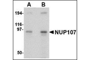 Image no. 2 for anti-Nucleoporin 107kDa (NUP107) (Center) antibody (ABIN500393)