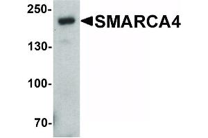 Image no. 3 for anti-SWI/SNF Related, Matrix Associated, Actin Dependent Regulator of Chromatin, Subfamily A, Member 4 (SMARCA4) (C-Term) antibody (ABIN6656208)