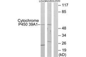 Image no. 2 for anti-Cytochrome P450, Family 39, Subfamily A, Polypeptide 1 (CYP39A1) (AA 361-410) antibody (ABIN1534395)
