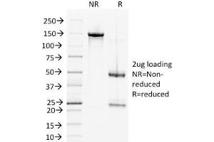Image no. 1 for anti-Desmoglein 2 (DSG2) antibody (ABIN6939266)