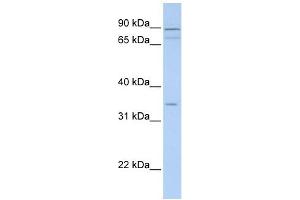 Image no. 1 for anti-Tenomodulin (TNMD) (Middle Region) antibody (ABIN634890)