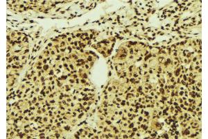 Image no. 1 for anti-Zinc Finger Protein 287 (ZNF287) antibody (ABIN6257559)
