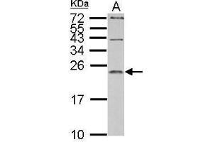 Image no. 4 for anti-Interleukin 1 Receptor Antagonist (IL1RN) (Center) antibody (ABIN2856394)