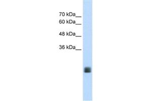 Image no. 1 for anti-Transmembrane Protein 178A (TMEM178A) antibody (ABIN2462646)