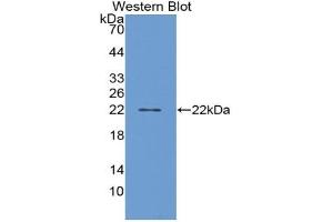PTGDS antibody  (AA 32-190)