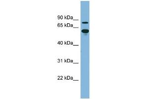 Image no. 1 for anti-ATP-Binding Cassette, Sub-Family F (GCN20), Member 2 (ABCF2) (N-Term) antibody (ABIN2781514)