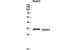Image no. 1 for anti-Alkaline Ceramidase 1 (ACER1) antibody (ABIN3181715)