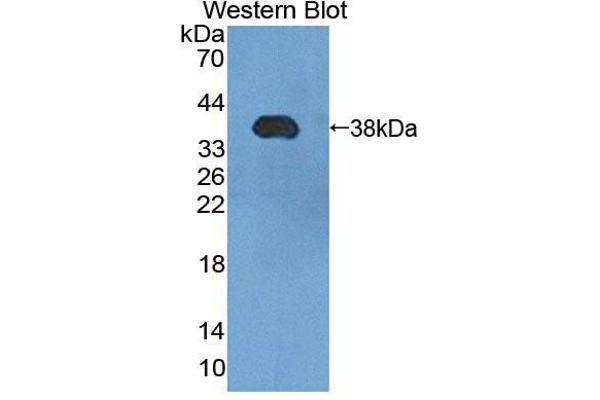 anti-Phosphomannomutase 1 (PMM1) (AA 2-262) antibody
