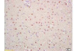 Formalin-fixed and paraffin embedded rat brain labeled with Rabbit Anti Phospho-p57 Kip2 (Thr310) Polyclonal Antibody, Unconjugated (ABIN703045) at 1:200 followed by conjugation to the secondary antibody and DAB staining