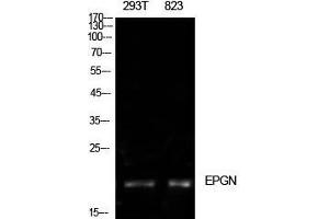 Image no. 2 for anti-Epithelial Mitogen (EPGN) (Internal Region) antibody (ABIN3181493)