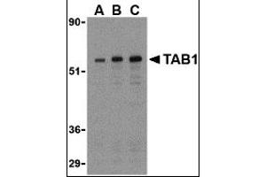 Image no. 1 for anti-TGF-beta Activated Kinase 1/MAP3K7 Binding Protein 1 (TAB1) (Middle Region) antibody (ABIN1031115)