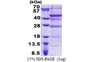 Image no. 1 for Retinoic Acid Induced 12 (RAI12) (AA 1-316) protein (His tag) (ABIN5853172)