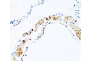 Immunohistochemistry of paraffin-embedded Rat lung using PHPT1 Polyclonal Antibody at dilution of 1:100 (40x lens).
