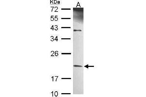 Image no. 4 for anti-TBP-Like 1 (TBPL1) (C-Term) antibody (ABIN2855905)