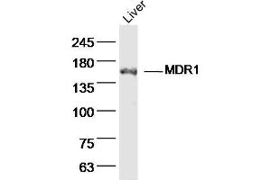 Image no. 4 for anti-ATP-Binding Cassette, Sub-Family B (MDR/TAP), Member 1B (ABCB1B) (AA 21-100) antibody (ABIN670161)