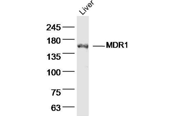ATP-Binding Cassette, Sub-Family B (MDR/TAP), Member 1B (ABCB1B) (AA 21-100) antibody