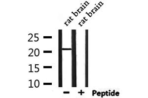 Image no. 1 for anti-Transmembrane Protein 37 (TMEM37) (N-Term) antibody (ABIN6265613)