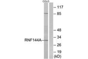 Image no. 1 for anti-Ring Finger Protein 144A (RNF144A) (AA 151-200) antibody (ABIN1534870)