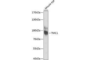 TMC1 抗体  (AA 600-700)
