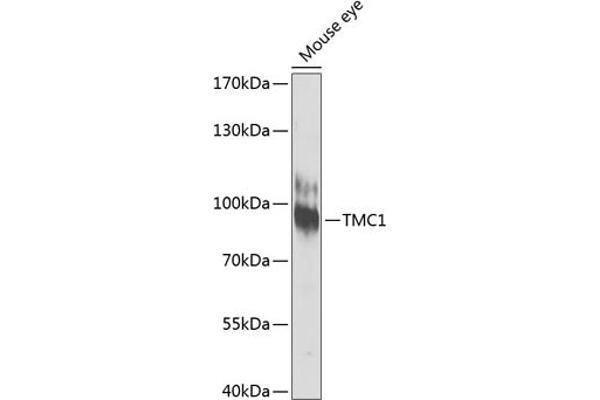 TMC1 抗体  (AA 600-700)
