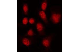 Image no. 8 for anti-GATA Binding Protein 1 (Globin Transcription Factor 1) (GATA1) (pSer142) antibody (ABIN6254982)