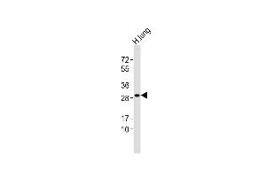 Image no. 2 for anti-Glutathione S-Transferase theta 1 (GSTT1) (AA 7-34), (N-Term) antibody (ABIN656825)