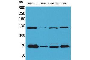 Image no. 1 for anti-K-Cadherin (CDH6) (Internal Region) antibody (ABIN3187664)