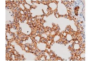 Image no. 4 for anti-Spleen tyrosine Kinase (SYK) (pTyr525) antibody (ABIN6255944)