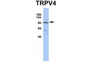 Image no. 4 for anti-Transient Receptor Potential Cation Channel, Subfamily V, Member 4 (TRPV4) (Middle Region) antibody (ABIN2776284)