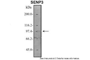 Image no. 3 for anti-SUMO/sentrin Specific Peptidase 3 (SENP3) (N-Term) antibody (ABIN2786148)