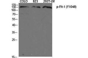 Image no. 1 for anti-Fms-Related tyrosine Kinase 1 (VEGFR1) (FLT1) (pTyr1048) antibody (ABIN3182936)