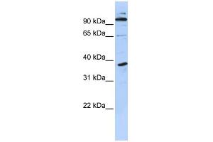 Image no. 1 for anti-PHD Finger Protein 11 (PHF11) (N-Term) antibody (ABIN2780996)