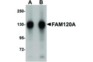 Image no. 1 for anti-Family with Sequence Similarity 120A (FAM120A) (Internal Region) antibody (ABIN6657094)