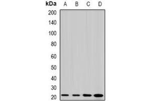 Image no. 1 for anti-Lens Intrinsic Membrane Protein 2, 19kDa (LIM2) (full length) antibody (ABIN6004526)