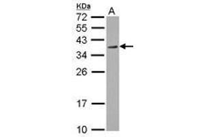Image no. 1 for anti-Regulation of Nuclear Pre-mRNA Domain Containing 1A (RPRD1A) (AA 103-312) antibody (ABIN1500758)