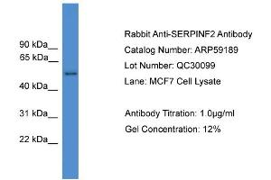 Image no. 2 for anti-Alpha2 Antiplasmin (SERPINF2) (N-Term) antibody (ABIN2787972)