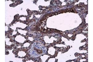 Image no. 6 for anti-Anterior Gradient 3 (AGR3) (Center) antibody (ABIN2854800)