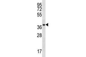 Image no. 2 for anti-Proteasome Subunit alpha Type 1 (PSMA1) (AA 234-262) antibody (ABIN3032353)