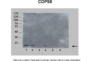 Image no. 2 for anti-COP9 Signalosome Subunit 8 (COPS8) (Middle Region) antibody (ABIN2784840)