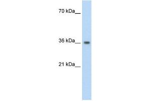anti-Phytanoyl-CoA 2-Hydroxylase Interacting Protein (PHYHIP) (N-Term) antibody