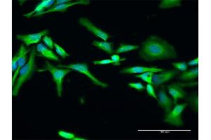 Image no. 5 for anti-RELT Tumor Necrosis Factor Receptor (RELT) (AA 1-430) antibody (ABIN529851)