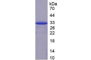 Image no. 1 for Coagulation Factor II (thrombin) (F2) ELISA Kit (ABIN6574219)