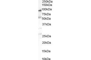Image no. 1 for anti-Oxysterol Binding Protein-Like 10 (OSBPL10) (Internal Region) antibody (ABIN185497)