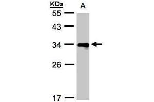 Image no. 1 for anti-Major Histocompatibility Complex, Class II, DR beta 4 (HLA-DRB4) (Center) antibody (ABIN2854374)