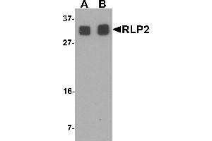 Western blot analysis of RLP2 in A549 cell lysate with RLP2 antibody at (A) 1 and (B) 2 µg/mL.