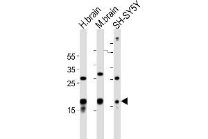 STMN2 抗体  (AA 82-116)