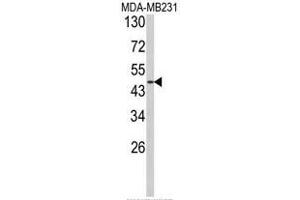 Image no. 2 for anti-Adrenergic, alpha-2B-, Receptor (ADRA2B) (AA 349-378) antibody (ABIN453503)