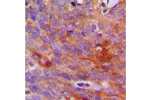 Image no. 2 for anti-Collagen, Type I, alpha 2 (COL1A2) (N-Term) antibody (ABIN2707434)