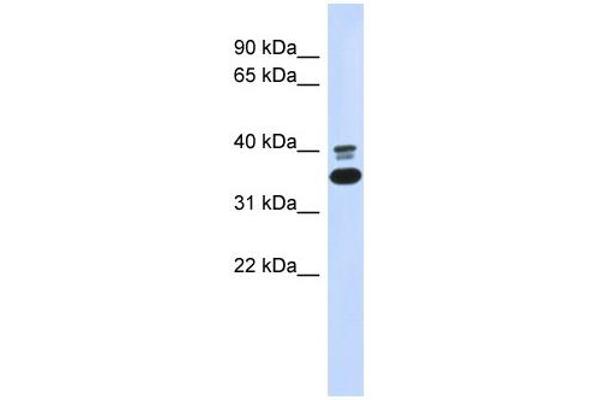 anti-Epoxide Hydrolase 4 (EPHX4) (N-Term) antibody