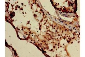 Immunohistochemistry of paraffin-embedded human testis tissue using ABIN7149567 at dilution of 1:100